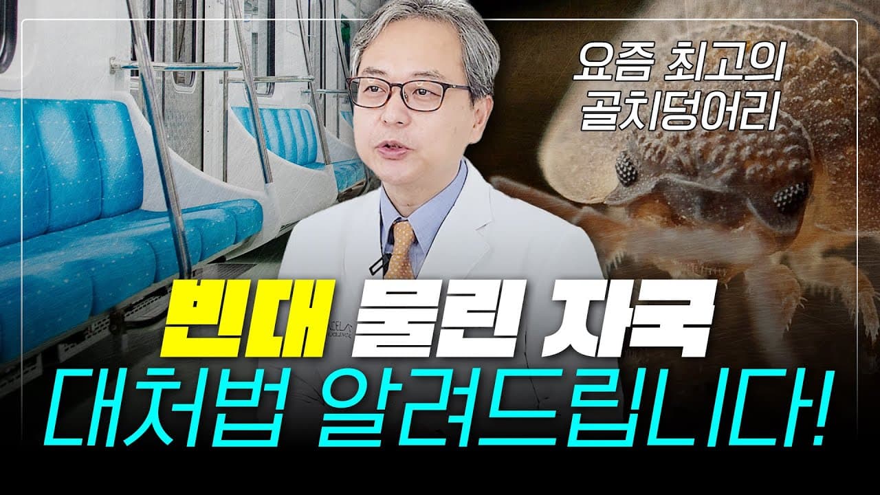 빈대 물린 자국, 확실한 대처법! 피부과 전문의가 알려드립니다