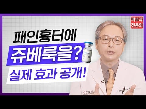 패인흉터 치료에 ✨ 쥬베룩 해봤더니!!! 피부과전문의 실제 시술 후기👨🏻‍⚕️여드름 흉터