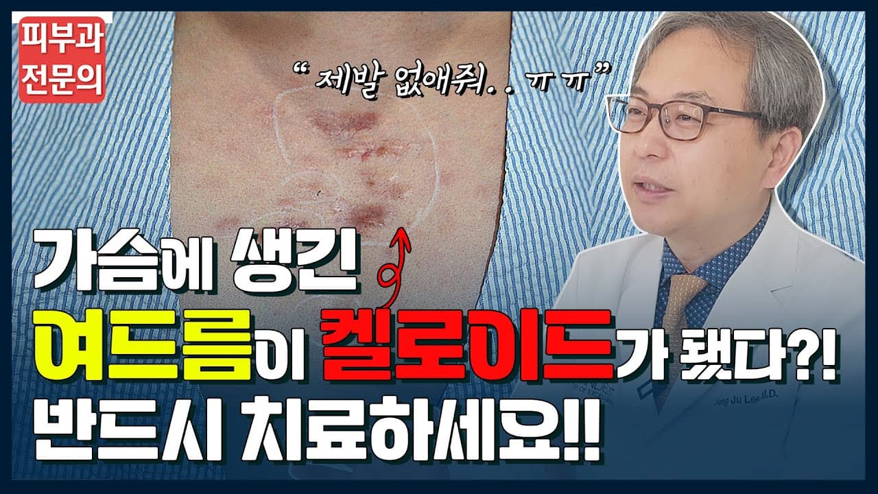 가슴에 생긴 여드름이 켈로이드로 변했다고요!? 켈로이드 완벽하게 없애는법!