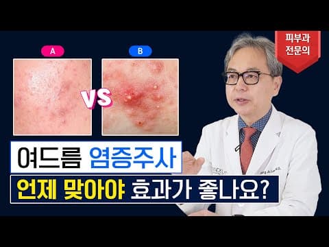 ニキビの炎症注射はいつ打つのが良い？（炎症注射を打つ前に必見）