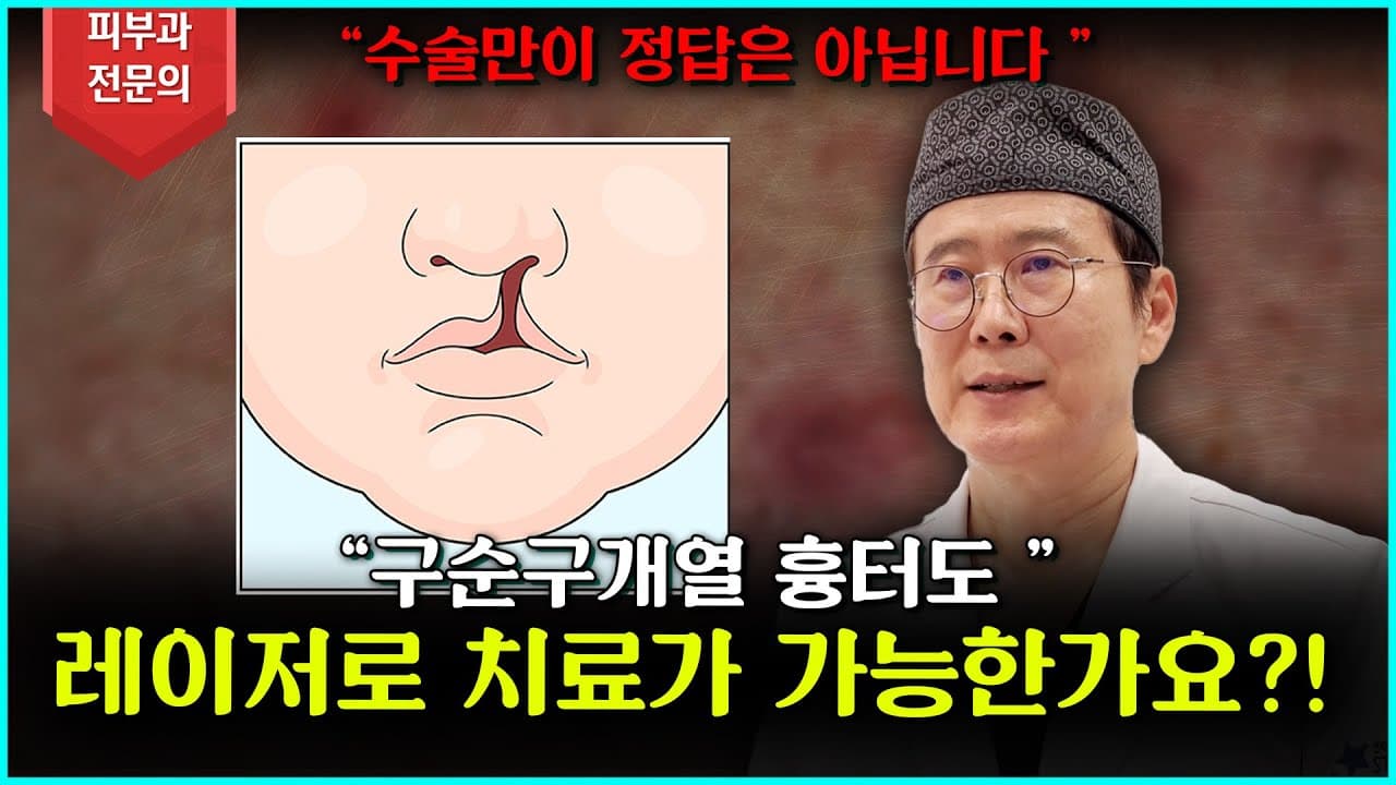 [구순구개열 흉터] 레이저로 깔끔하게 치료가 가능할까요?