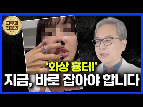 미루면 안됩니다. 지금바로 치료해야합니다