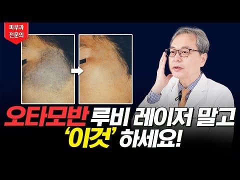 오타모반 제거 ✨ 루비레이저 보다 효과 좋은 레이저 치료 알려드립니다!
