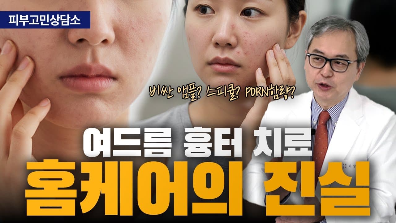 여드름 흉터는 화장품이 닿지 못하는 무너진 땅이라고 봅니다 | 신촌 연세스타피부과