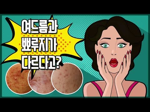 Acne Versus Pimples: Telling The Difference And Treating Each
