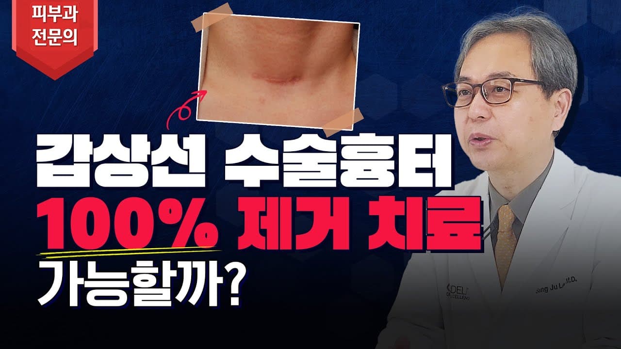 Thyroid Surgery Scar Can It Be Fully Removed