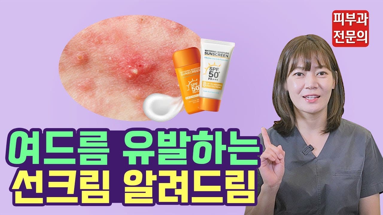 Sunscreen Causing Acne Use Sunblock On Acne-Prone Skin Like This