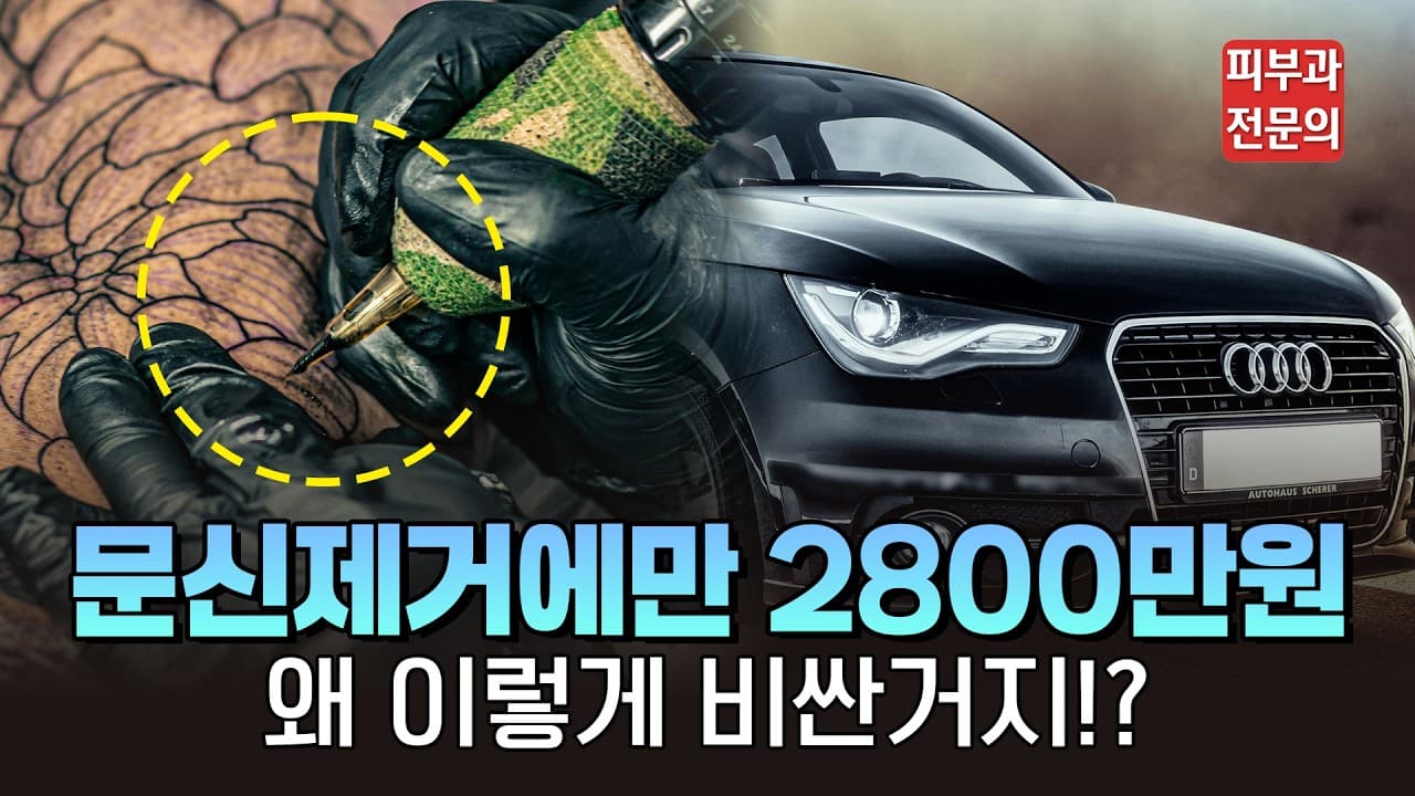 문신 제거 비용이 왜 차이 나는지, 시작 전에 꼭 짚는 세 가지 | 신촌 연세스타피부과