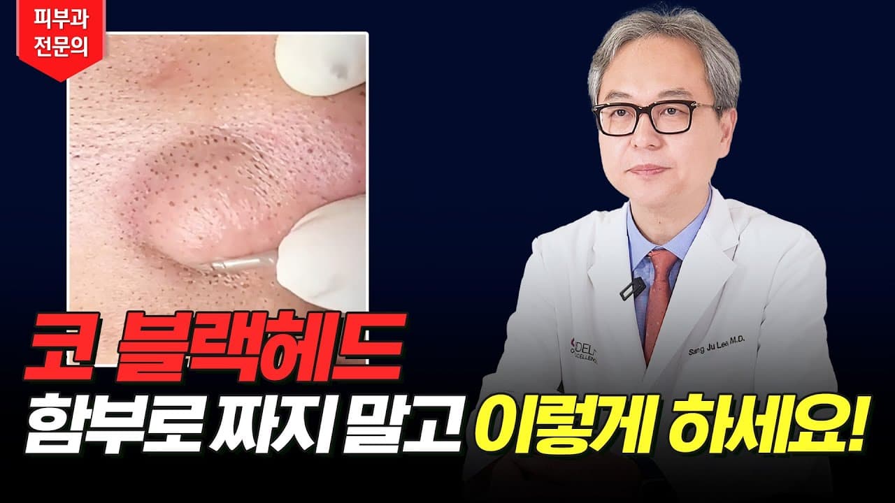 피부과 의사가 직접 알려주는 블랙헤드 없애는 방법!!