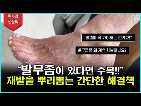 足水虫、絶対にこのままにしてはいけません！今まで苦しんでいる人集まれ