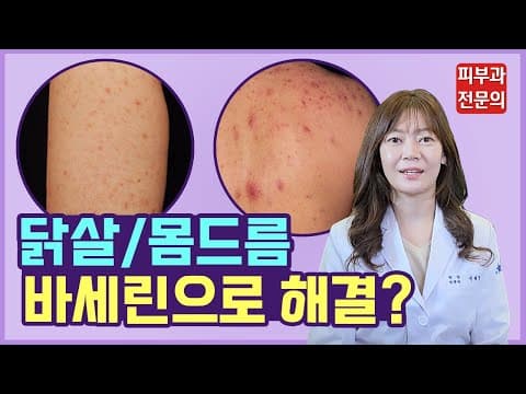 몸에 오돌토톨 닭살🐔&몸드름 때 밀면 없어지나요? | 모공각화증, 등드름 가드름 없애는 법 제대로 알려줄게!