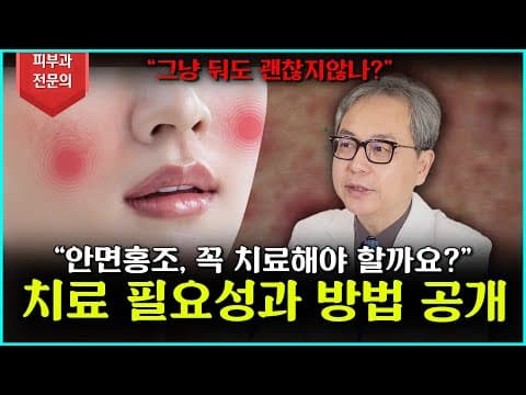 [안면홍조] 왜 꼭 치료를 해야 할까요?