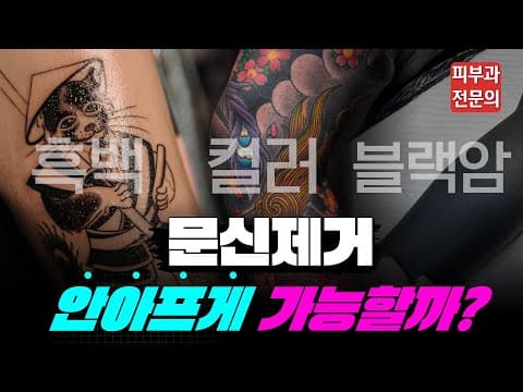 タトゥー除去の痛み 痛くなく施術できる？