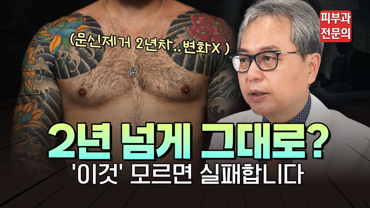 이레즈미 문신 제거 2년째 제자리 걸음인 분들, 피부과 전문의가 팩트만 말씀드립니다 #문신제거병원 #문신제거후기 #타투제거