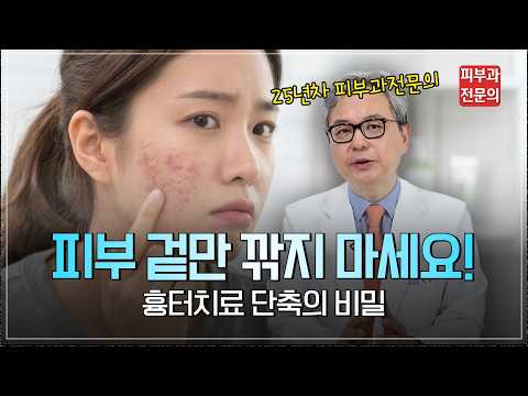 크림도 레이저도 안 듣는 여드름 흉터, 피부과 전문의가 짚는 이유