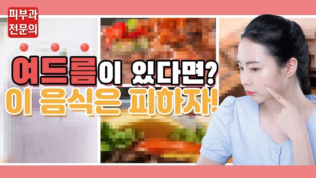 여드름이 심하다면? 이 음식 때문?