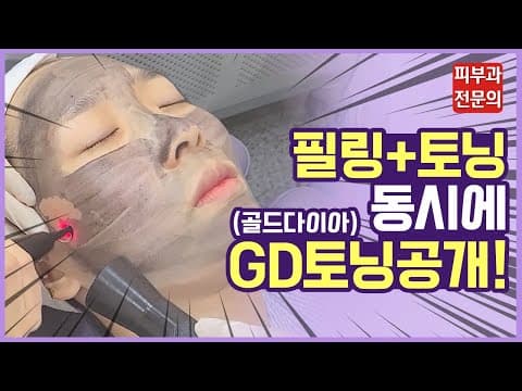 [최초공개] 피부과전문의의 NEW 레이저토닝 시술 후기! 골드랑 다이아를 얼굴에?_ 레이저토닝, 화이트닝, 기미레이저, 기미없애는법, 색소레이저, GD(골드다이아)토닝