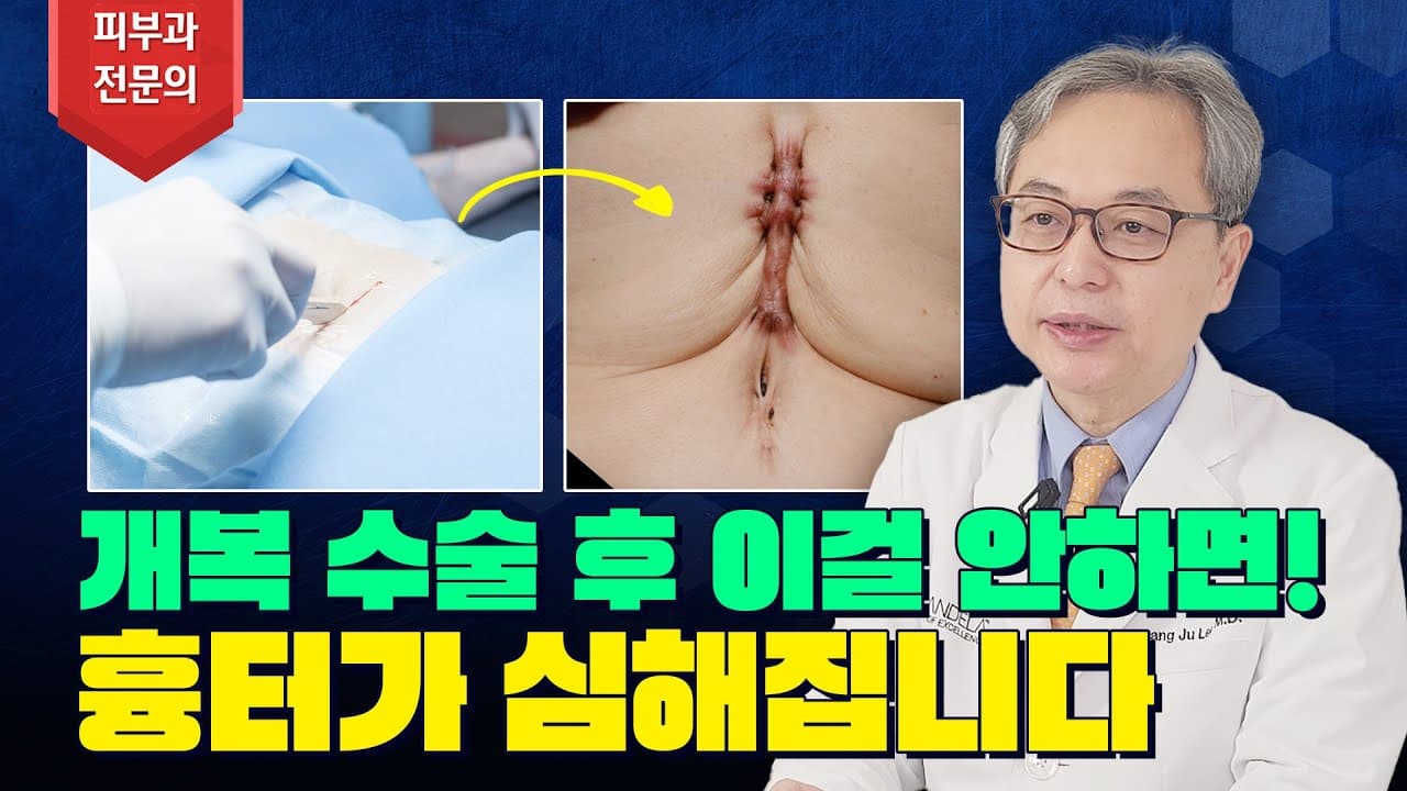不想留下开腹手术疤痕必看 癌症术后护理