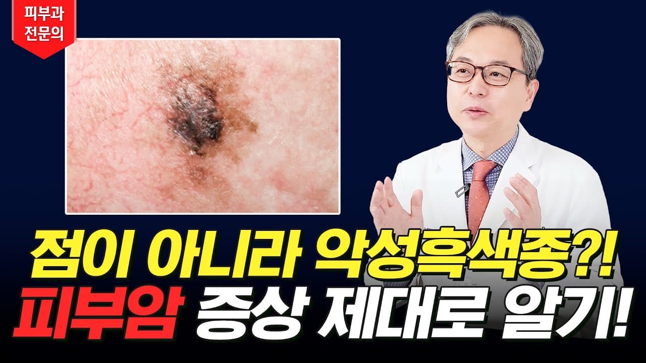 점이 아니라 악성흑색종이었다고..?! 이 영상 보고 피부암 구별해보세요!