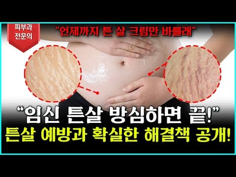 [임신 튼살] 이렇게 관리하면 달라집니다! 튼살 예방과 확실한 해결책 공개!