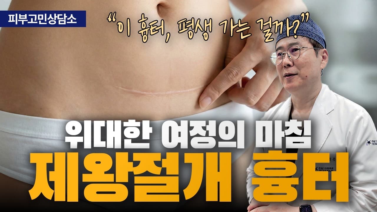 제왕절개 흉터, 저는 만들지 못하게 막고 이미 생긴 건 분해합니다 | 신촌 연세스타피부과