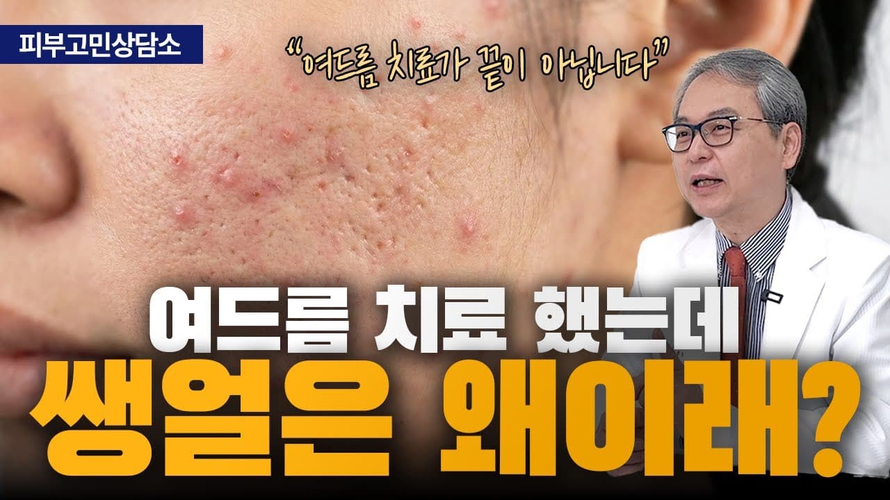 여드름은 졸업했는데 흔적이 남았다면 원인을 셋으로 나눠 봅니다 | 신촌 연세스타피부과
