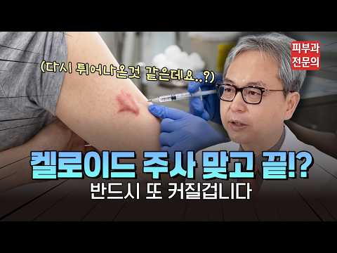 켈로이드 주사만으로 충분할까? 재발률을 낮추는 핵심 비결