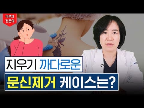 피부과 전문의도 힘들어 하는 까다로운 문신! 어떻게 지울까?