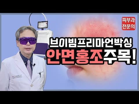 안면홍조 없애는 법 | 브이빔 레이저 후기 (faet. 브이빔 프리마)