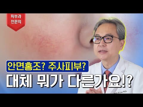 일반 홍조인 줄 알았는데 주사피부라고요? | 주사피부(Rosacea)에 모든 것!