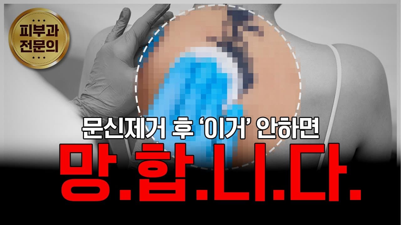문신 제거보다 더 중요한 건 '이것'입니다!