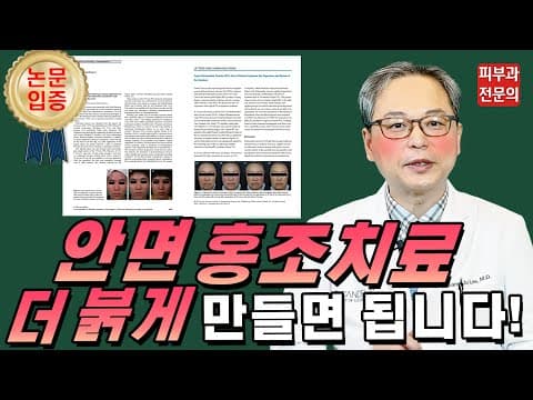 세계적 학회에 소개한 😡 안면홍조 없애는법 😡 공개 (Feat. 홍반유도프리마)