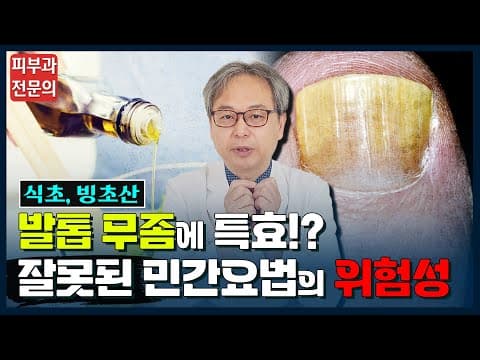 足の爪水虫の民間療法は本当に効果がある？