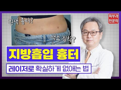吸脂疤痕与色素沉着彻底去除的方法 不留疤痕的预防护理