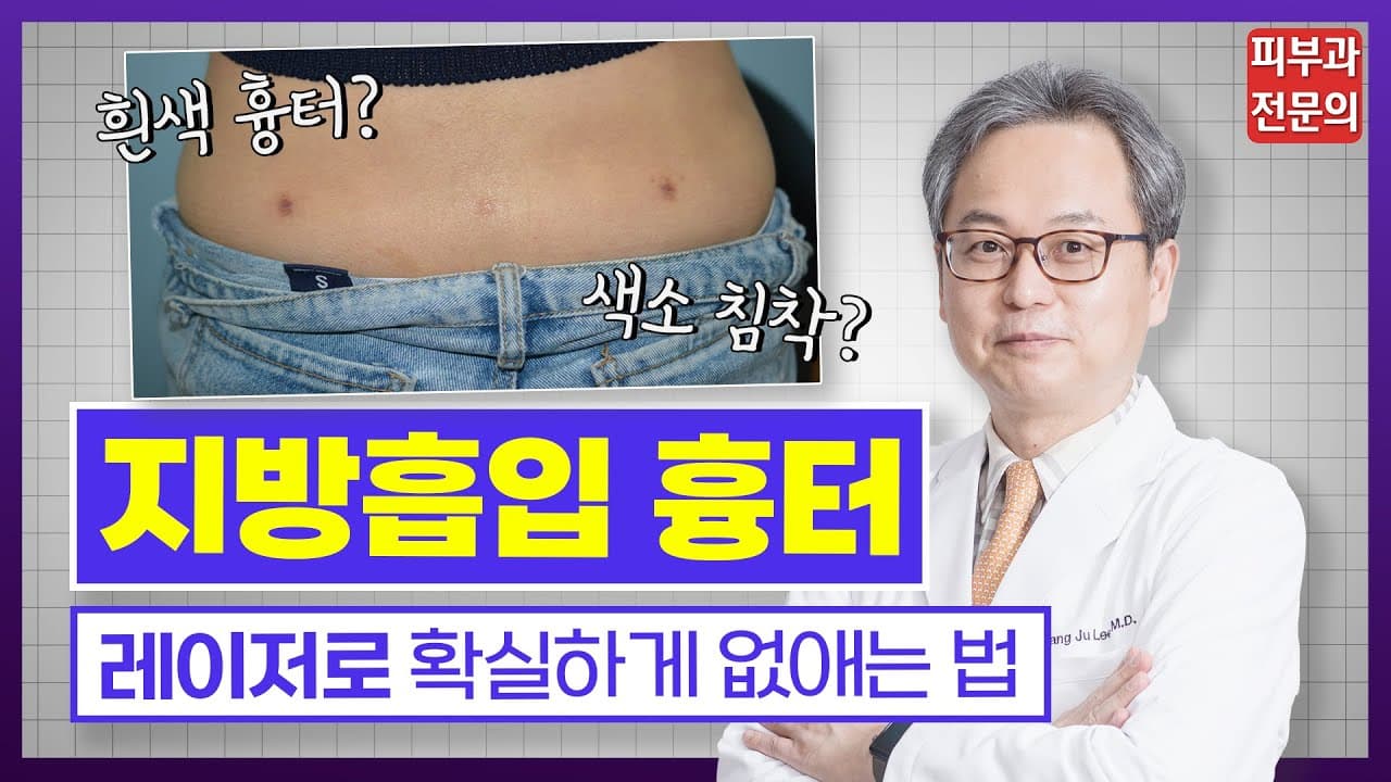 지방흡입 흉터 & 색소침착 확실하게 없애는 법 ‼ 알려드립니다 | ✅ 지흡 수술 흉터 안남기는 예방 관리 노하우