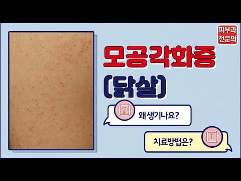 모공각화증(닭살피부)이 고민되는 분들이라면?