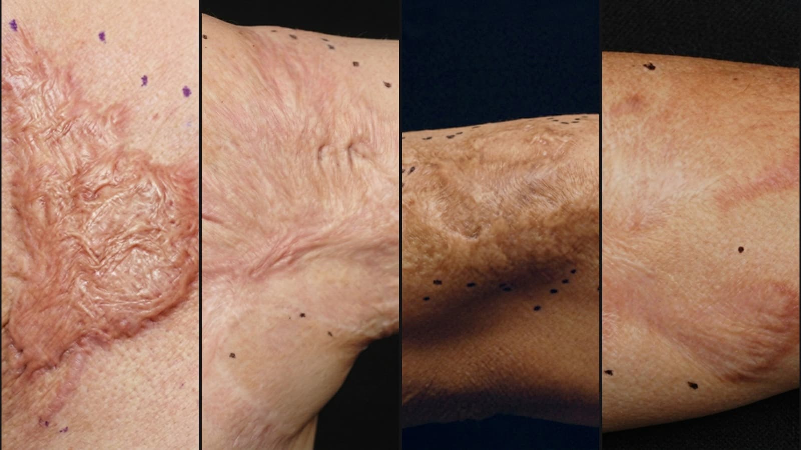 Signature Treatments