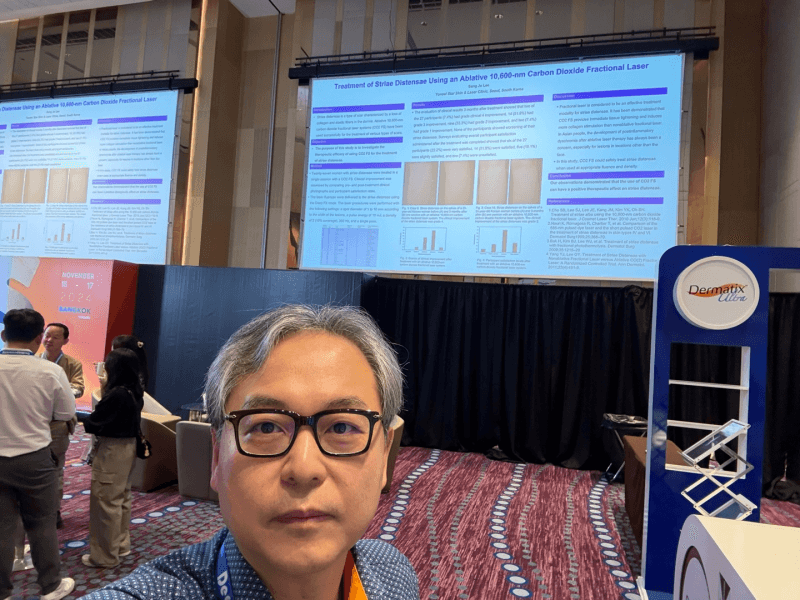 SCARS 2024 Conference Stretch Mark Treatment Presentation