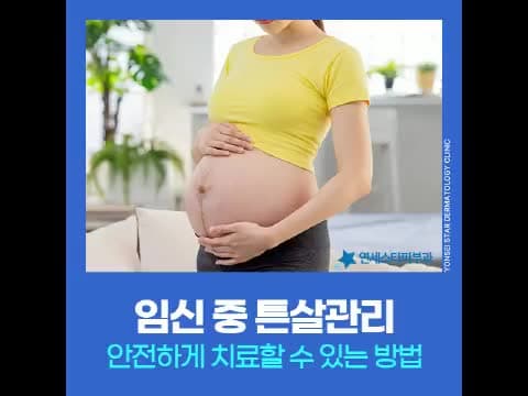 임신 중 튼살 관리부터 출산 후 레이저 치료까지