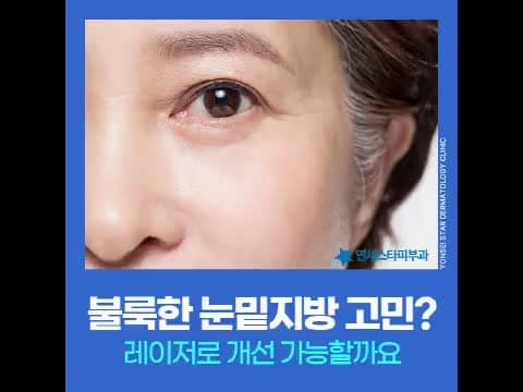 절개 없이 눈밑 지방 고민, 레이저 눈밑지방재배치로 접근하기