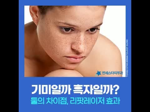 기미와 흑자의 차이, 피코와 리팟 레이저 선택 기준