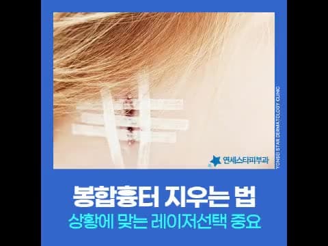 봉합흉터 레이저치료 양상, 상태에 따른 유형별 레이저 접근법