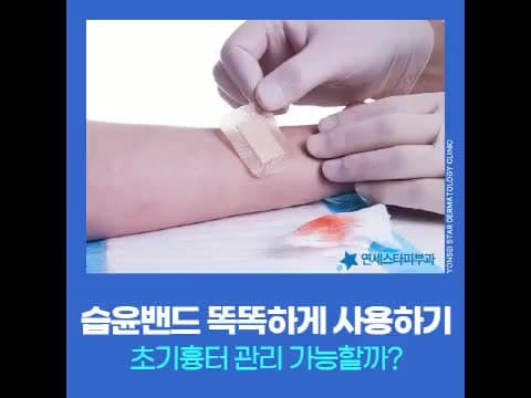 습윤밴드 교체시기 등 올바른 사용방법 초기흉터 등 예방에 도움 되는 이유