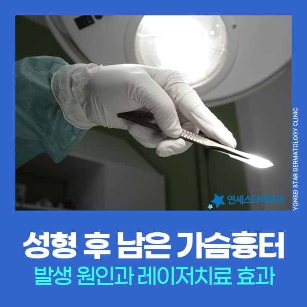 신촌 가슴성형수술흉터 관리가 중요한 이유, 레이저 흉터치료 효과 | 연세스타피부과