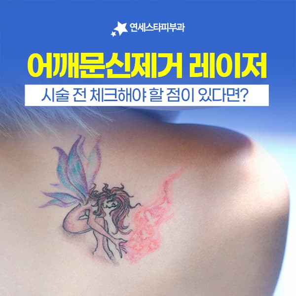 어깨타투제거 특징부터 문신제거통증 관리 : 레이저 시술 장비 조합까지 정리