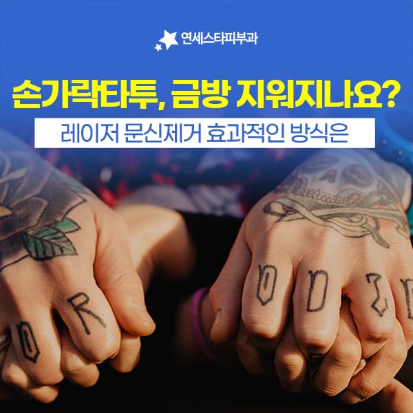 연세스타피부과 신촌 | 손가락 미니타투제거, 작다고 쉽게 지워질까요?