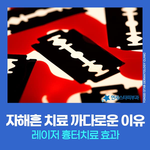손목 등 자해흔 흉터 없애는법 레이저치료 효과 핀홀법 추천 | 연세스타피부과 신촌