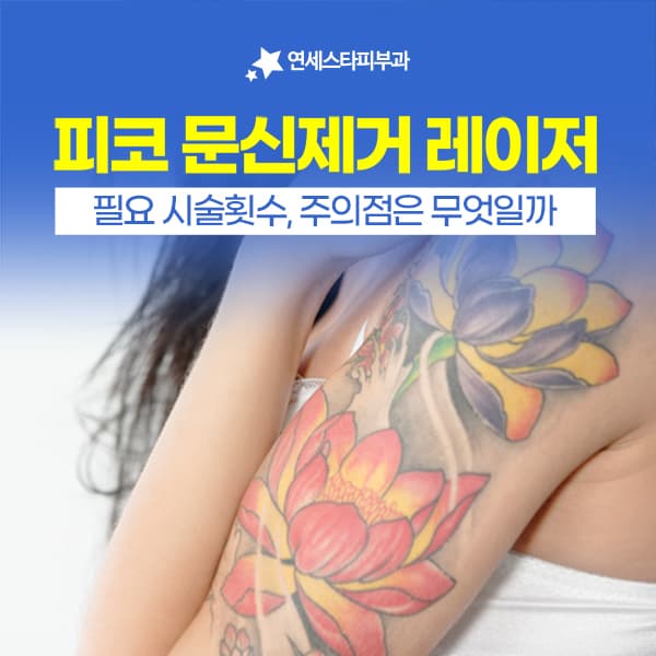 신촌 피코문신제거 효과와 장점, 문신제거레이저 선택 전 체크리스트 | 연세스타피부과 신촌본점
