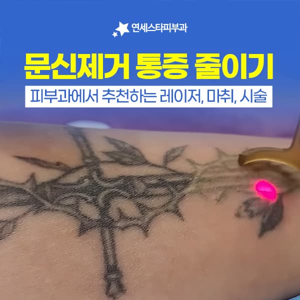 How to Reduce Tattoo Removal Pain: Managing Laser Tattoo Pain