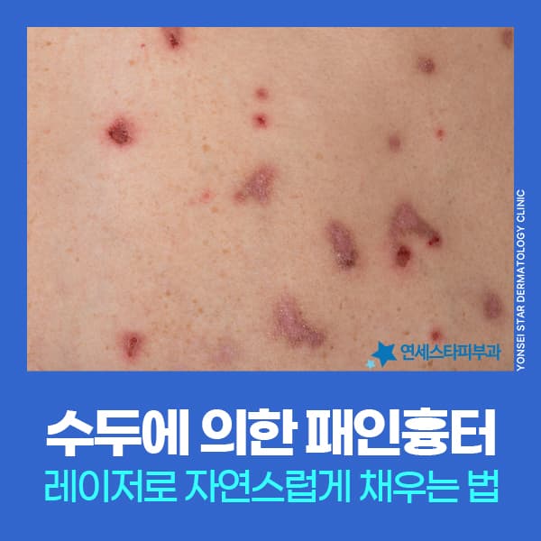 blog-224416279071